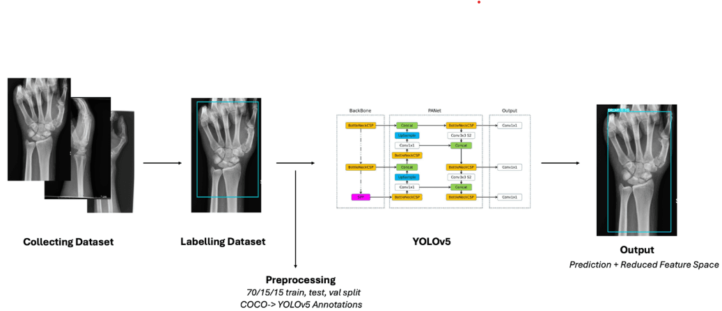Our Vision: AI for Smarter Orthopaedic Care