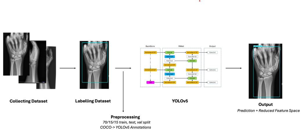 Our Vision: AI for Smarter Orthopaedic Care