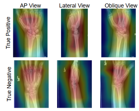 Computer Vision for Radiographic Analysis